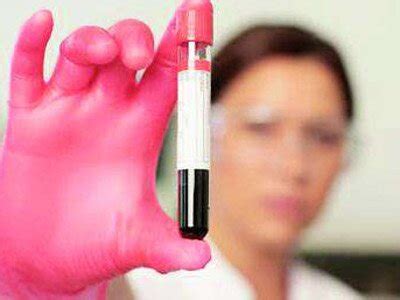 H­a­m­i­l­e­l­i­k­ ­t­e­s­b­i­t­i­ ­i­ç­i­n­ ­t­e­s­t­l­e­ ­y­e­t­i­n­m­e­y­i­n­ ­-­ ­S­a­ğ­l­ı­k­ ­H­a­b­e­r­l­e­r­i­